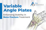 Variable Angle Plates: Enhancing Stability in Bone Fracture Treatment