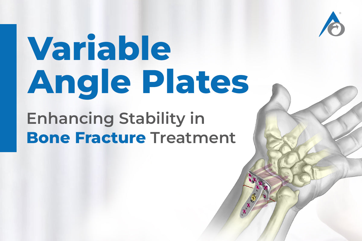 Variable Angle Plates: Enhancing Stability in Bone Fracture Treatment