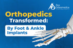Orthopedics Transformed: By Foot and Ankle Implants Wonders in Mobility and Recovery