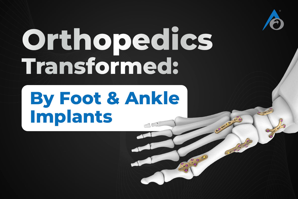 Orthopedics Transformed: By Foot and Ankle Implants Wonders in Mobility and Recovery