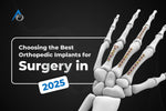 Choosing the Best Orthopedic Implants for Surgery in 2025