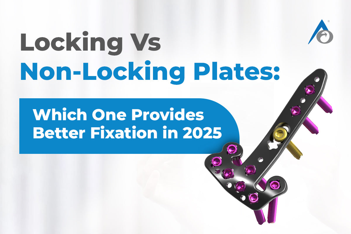 Locking Vs Non-Locking Plates: Which One Provides Better Fixation in 2025