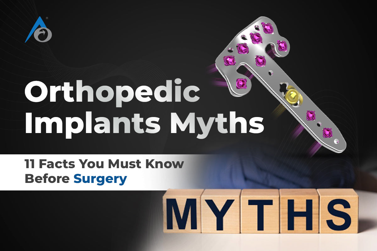 Orthopedic Implants Myths: 11 Facts You Must Know Before Surgery