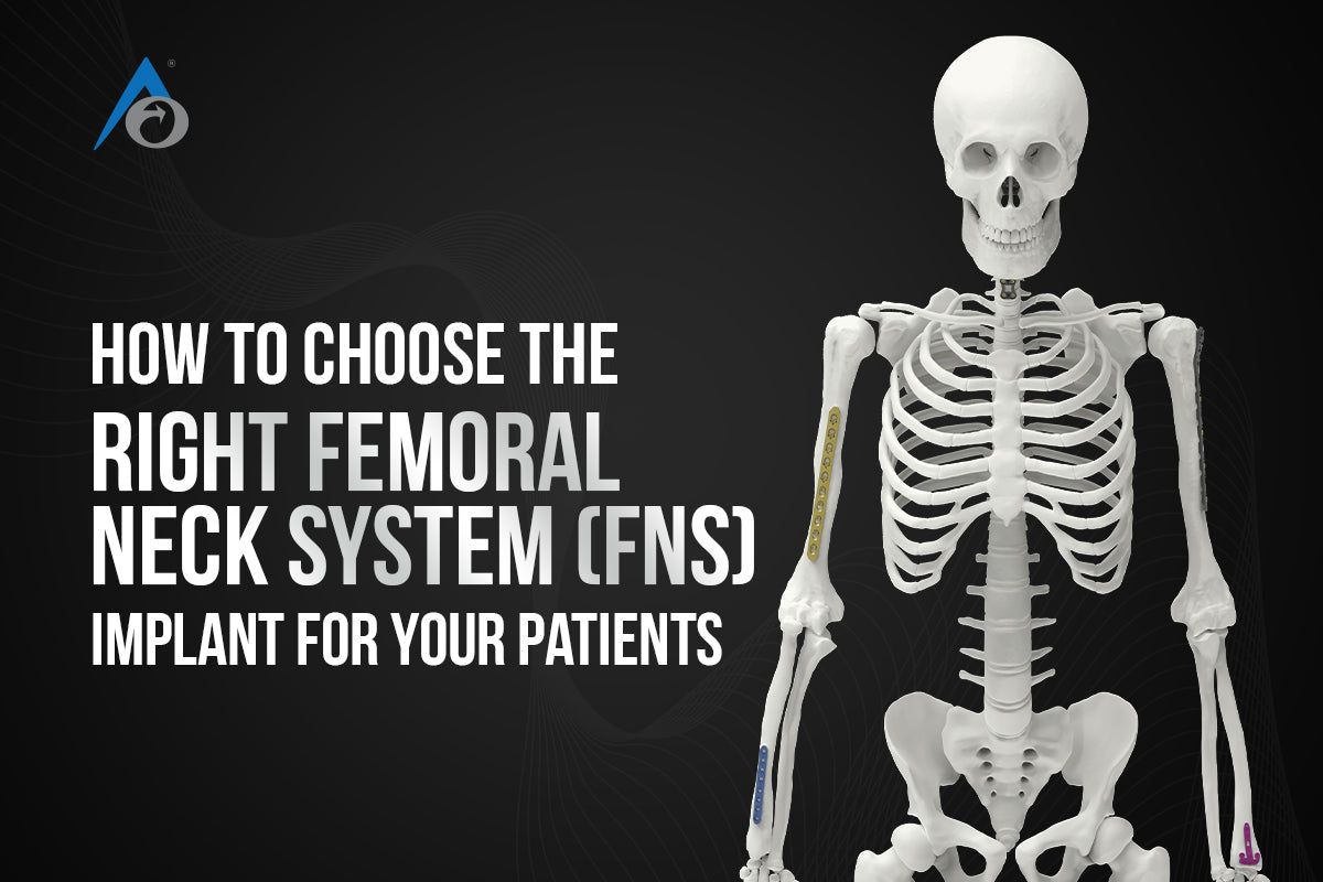 How to Choose the Right Femoral Neck System (FNS) Implant for Your Patients