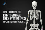 How to Choose the Right Femoral Neck System (FNS) Implant for Your Patients