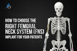 How to Choose the Right Femoral Neck System (FNS) Implant for Your Patients