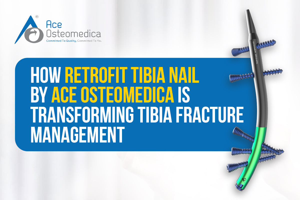 How Retrofit Tibia Nail by Ace Osteomedica is Transforming Tibia Fracture Management