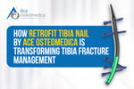 How Retrofit Tibia Nail by Ace Osteomedica is Transforming Tibia Fracture Management