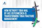How Retrofit Tibia Nail by Ace Osteomedica is Transforming Tibia Fracture Management