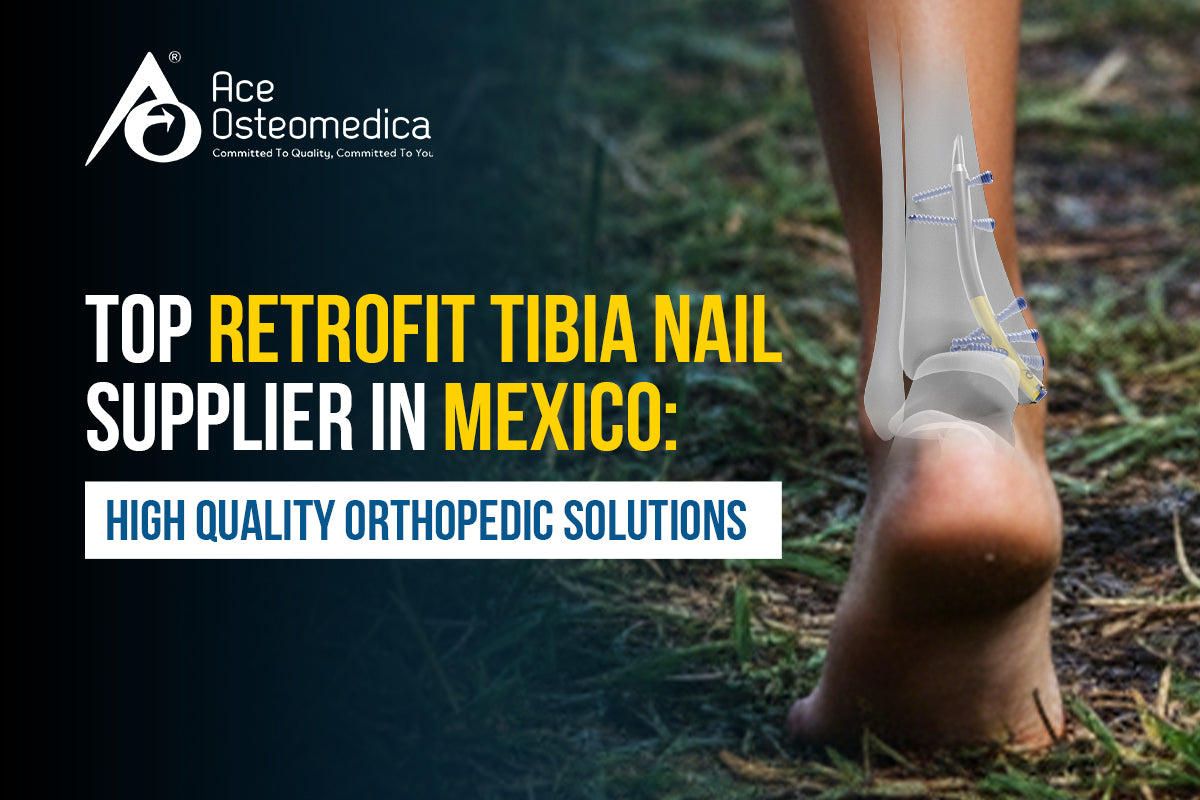 Top Retrofit Tibia Nail Supplier in Mexico: High Quality Orthopedic Solutions
