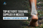Top Retrofit Tibia Nail Supplier in Mexico: High Quality Orthopedic Solutions