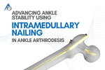 Advancing Ankle Stability using Intramedullary Nailing in Ankle Arthrodesis