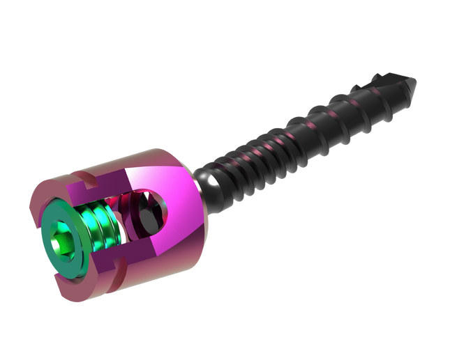 PEDICLE DUAL CORE POLY AXIAL