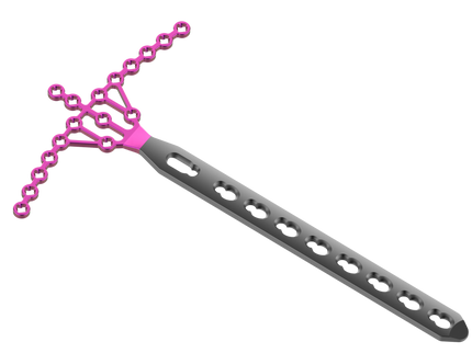 POLY - AX SECURE LOCKING PILON PLATE 2.7/3.5,M