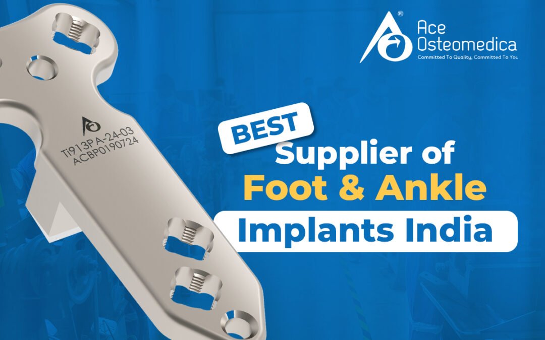 Best Suppliers of Foot and Ankle Implants