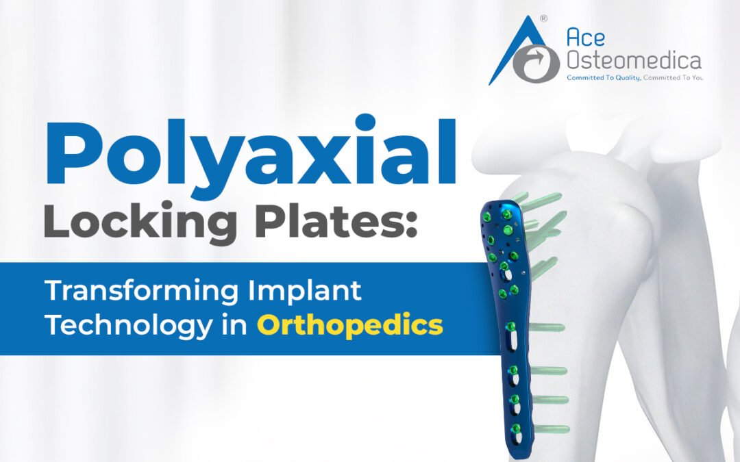 Polyaxial Locking Plates: Transforming Implant Technology in Orthopedics