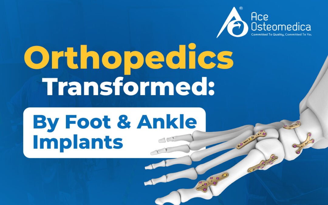 Orthopedics Transformed: By Foot and Ankle Implants