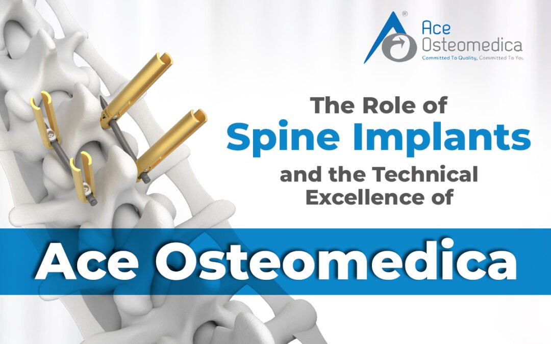 The Role of Spine Implants and the Technical Excellence of Ace Osteomedica