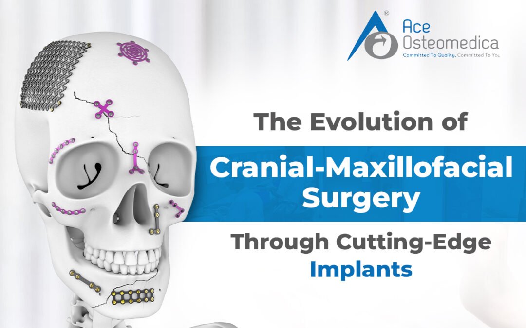 The Evolution of Cranial-Maxillofacial Surgery Through Cutting-Edge Implants