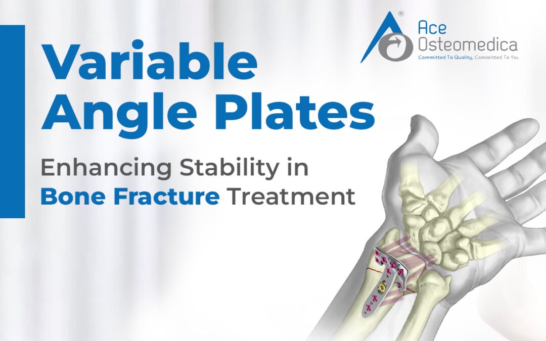 Variable Angle Plates: Enhancing Stability in Bone Fracture Treatment