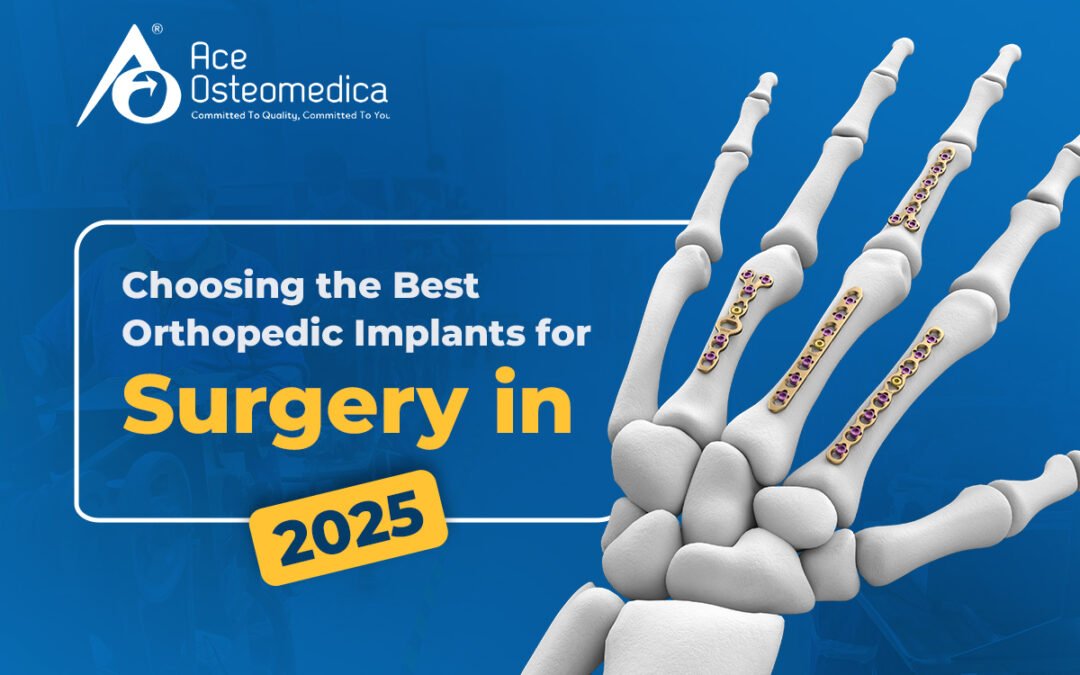 Choosing the Best Orthopedic Implants for Surgery in 2025