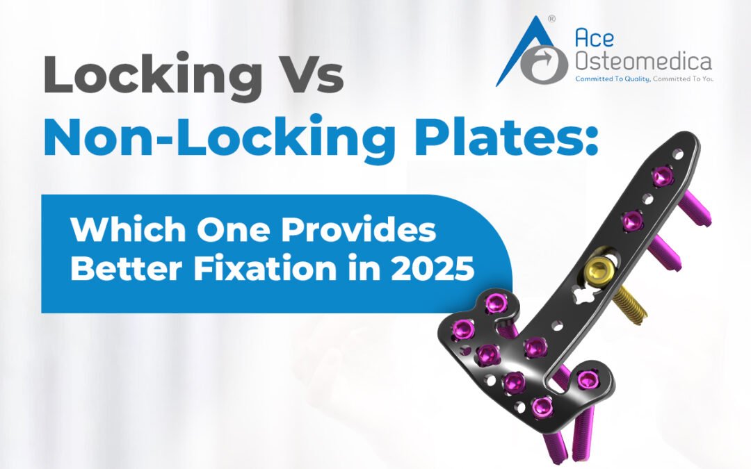 Locking Vs. Non-Locking Plates: Which One Provides Better  Fixation in 2025