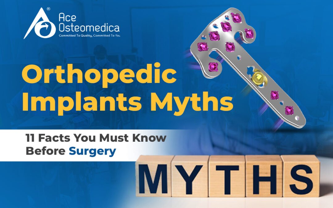 Orthopedic Implants Myths: 11 Must Know Facts Before Surgery